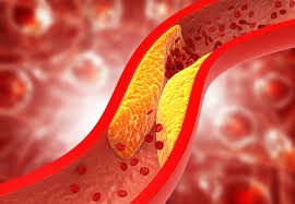 Heart and Cirtulatory
